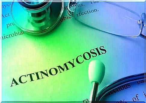 Actinomycosis: causes, diagnosis and treatment