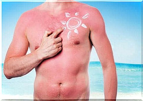 Adverse effects of the sun on the skin.