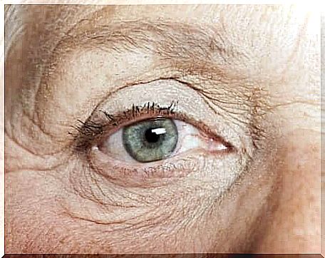 The eyelids inside the eye are usually benign