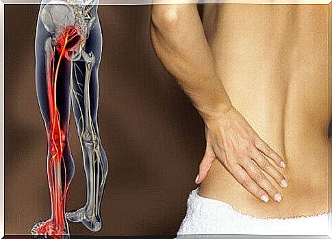 sciatic nerve and sciatica pain