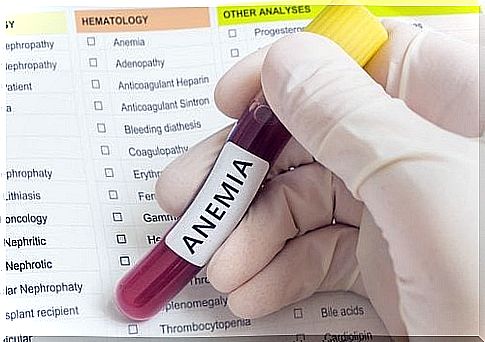 Consequences of iron deficiency - anemia.