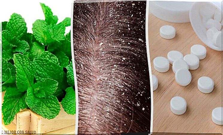 Get rid of dandruff with home treatments