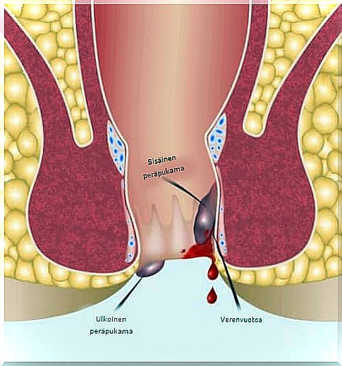 Rectal endoscopy - an overview of the procedure