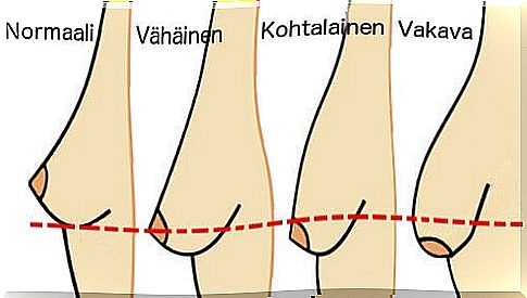 These things contribute to breast loosening