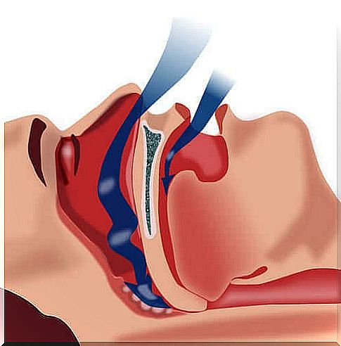 During sleep apnea, the normal breathing rhythm is blocked and sleep is interrupted, causing a person with sleep apnea to wake up several times during the same night.