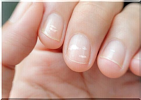 lines on the nails