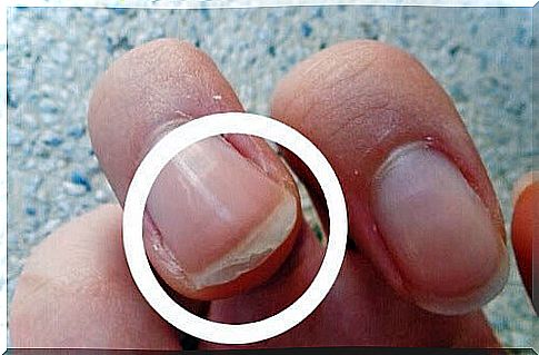 Why do nails slip?  Causes, treatments and solutions